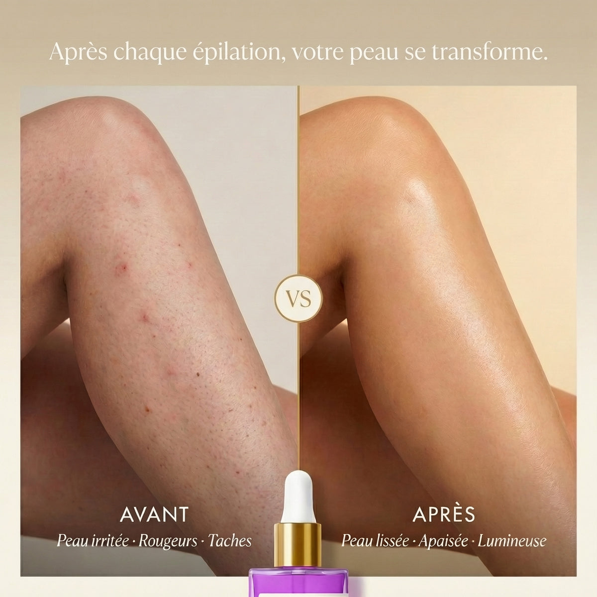 Avant Après Satinéa™ Elixir